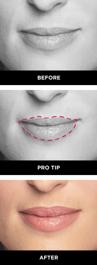 thin top lip guide