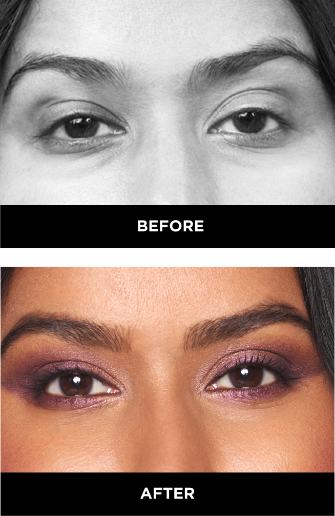 close set eyes before and after