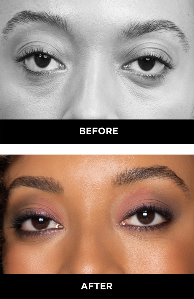 round eyes before and after