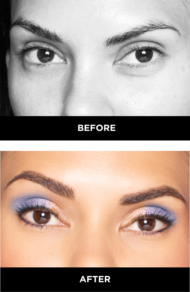 upturned eyes before and after